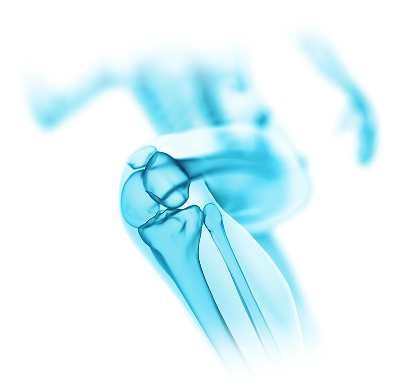 Sportheum_Sportklinik_Fellbach_Spezialisten_Knie_Experten_Knieverletzung_Sportunfall_innvovative_Sportmedizin_individueller_Therapieplan Sportmedizinische Fachpraxis Experten Knie individuelles Behandlungskonzept gesamtes Bewegungskonzept